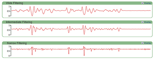 [Figure 6 AN250318-chemical-acquisition-raman-spectral-processing.png] Figure 6 AN250318-chemical-acquisition-raman-spectral-processing.png