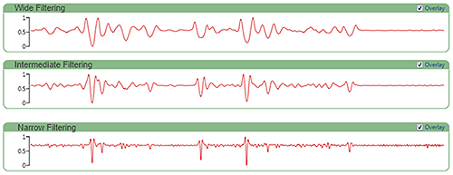 MRK1881_fig06